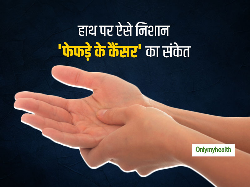 हथेलियों पर दिखाई दे ऐसा निशान तो हो सकता है फेफड़ों का कैंसर, शोधकर्ताओं ने बताया कारण
